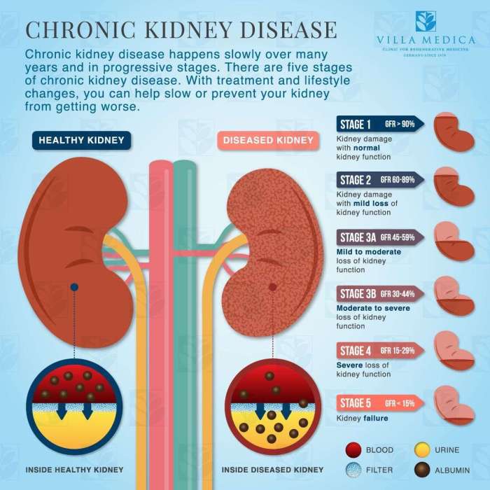 Hesi case study chronic renal failure