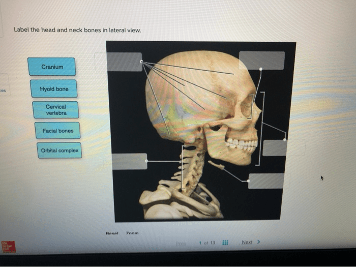 Label the head and neck bones in lateral view